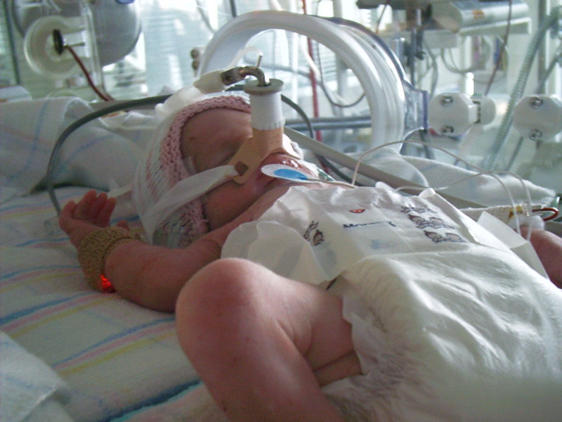 Is our approach to ventilation really harming babies?