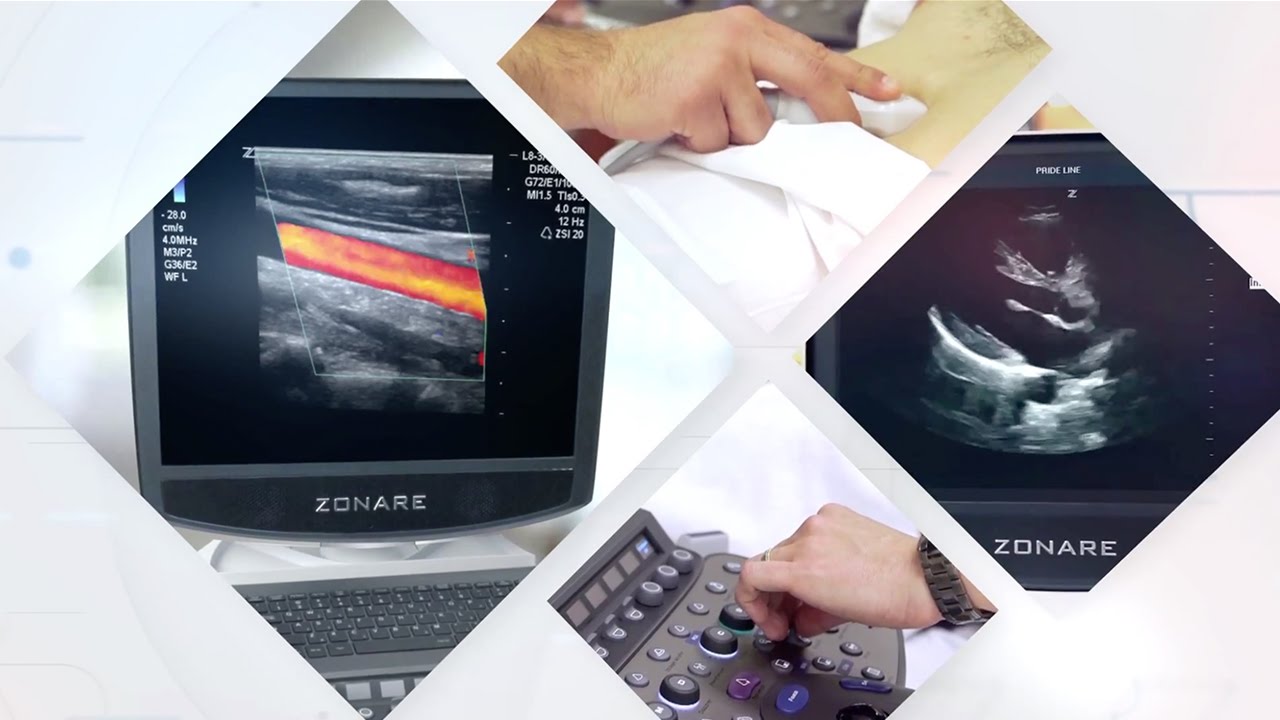 Point of Care Ultrasound: Changing Practice For The Better in NICU