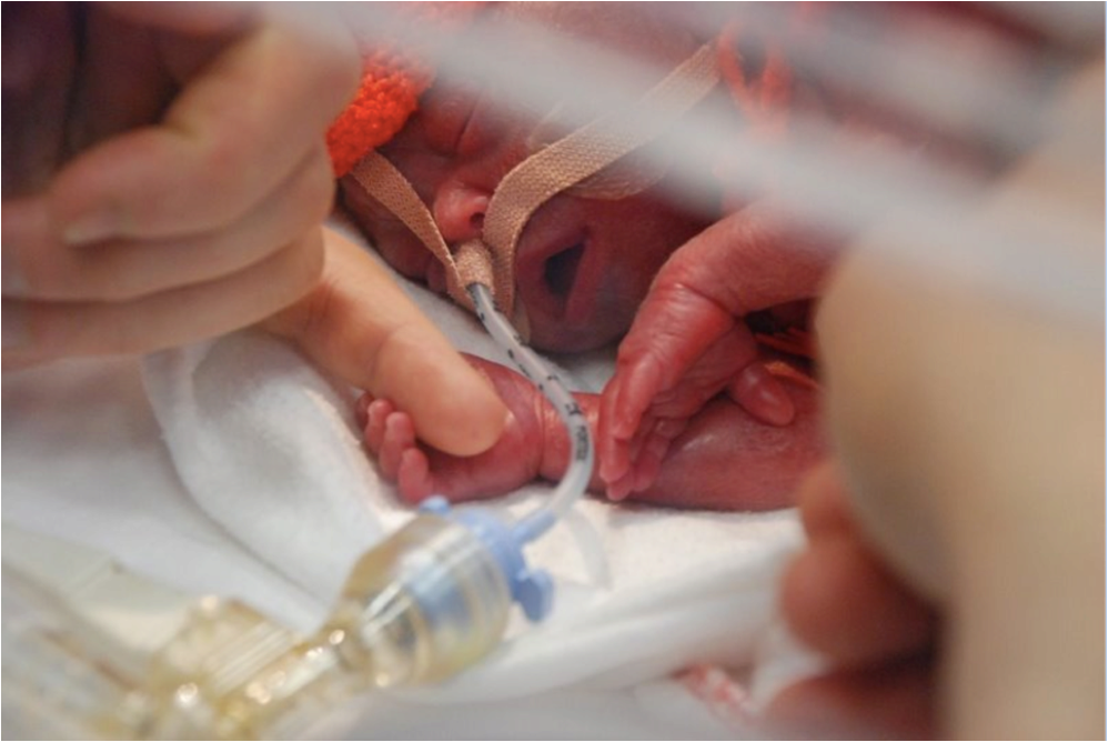The Psychological Benefit of Enrolling Your Preemie in Research.