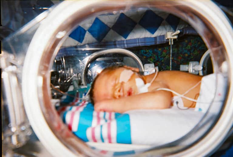 Hydrocortisone after birth may benefit the smallest preemies the most!