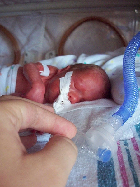 A one size fits all approach to preterm ventilation may not have been right all this time.