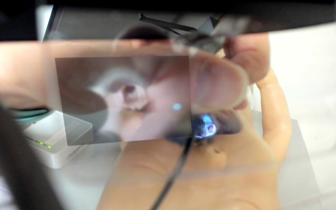 Augmented Reality: The Evolution of Video Laryngoscopy